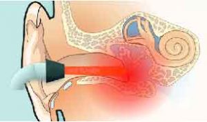 درمان وزوز گوش