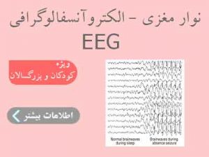 نوار مغزی EEG