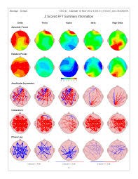 نوار مغز نقشه مغز QEEG EEG