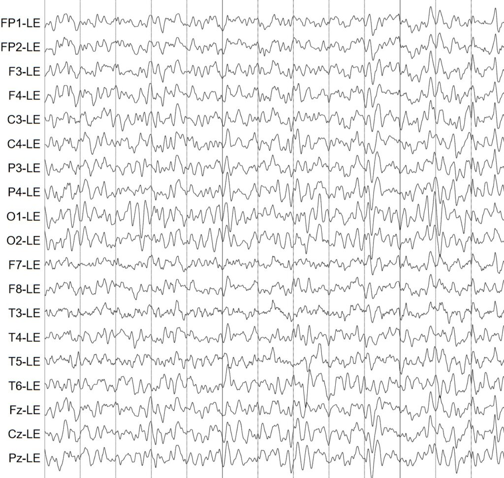 مرکز تخصصی نوار مغزی و نقشه مغزی در تهران